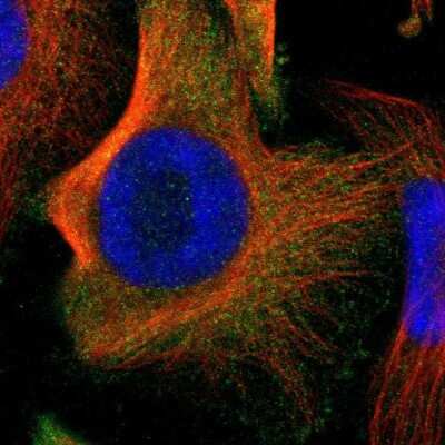 Immunocytochemistry/ Immunofluorescence: ARHGEF6 Antibody [NBP1-89124]