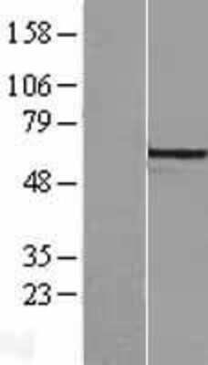 Western Blot: Collybistin/ARHGEF9 Overexpression Lysate [NBL1-07683]