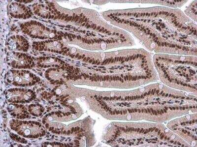 Immunohistochemistry-Paraffin: ARID1A Antibody (3611) [NBP2-43566]