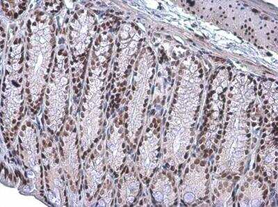 Immunohistochemistry-Paraffin: ARID1A Antibody (3611) [NBP2-43566]