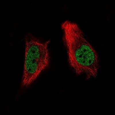 Immunocytochemistry/ Immunofluorescence: ARID1A Antibody (CL3595) [NBP2-61623]