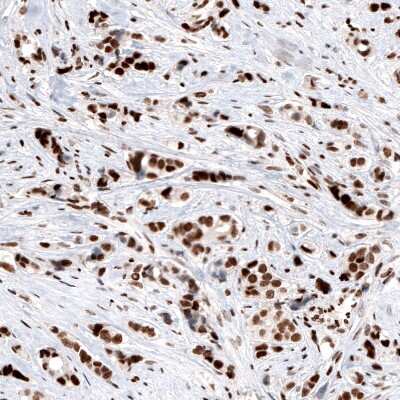 Immunohistochemistry-Paraffin: ARID1A Antibody (CL3595) [NBP2-61623]