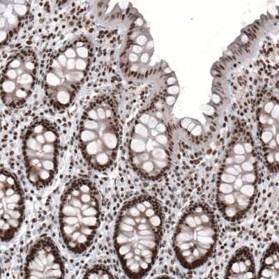 Immunohistochemistry-Paraffin: ARID1A Antibody (CL3595) [NBP2-61623]