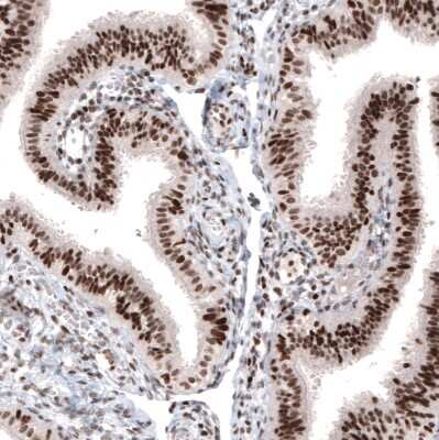 Immunohistochemistry-Paraffin: ARID1A Antibody (CL3595) [NBP2-61623]