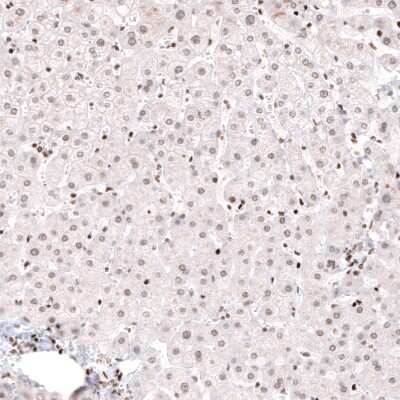 Immunohistochemistry-Paraffin: ARID1A Antibody (CL3595) [NBP2-61623]