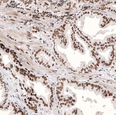 Immunohistochemistry-Paraffin: ARID1A Antibody (CL3595) [NBP2-61623]