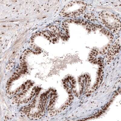 Immunohistochemistry-Paraffin: ARID1A Antibody (CL3595) [NBP2-61623]