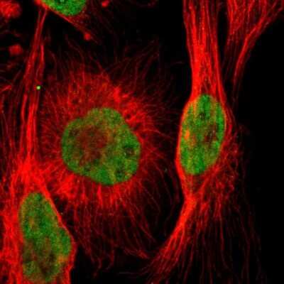Immunocytochemistry/ Immunofluorescence: ARID1A Antibody [NBP1-88932]