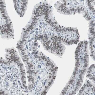 Immunohistochemistry-Paraffin: ARID1A Antibody [NBP1-88932]