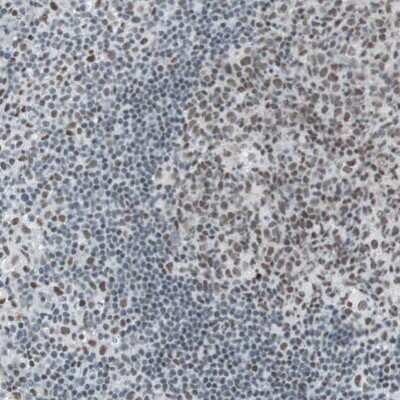 Immunohistochemistry-Paraffin: ARID1A Antibody [NBP1-88932]