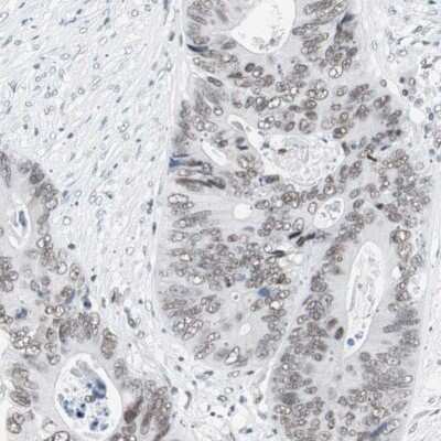 Immunohistochemistry-Paraffin: ARID1A Antibody [NBP1-88932]