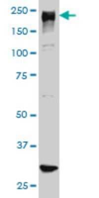 Western Blot: ARID1B Antibody (2D2) [H00057492-M01]