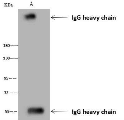 Immunoprecipitation: ARID2 Antibody [NBP3-12715]