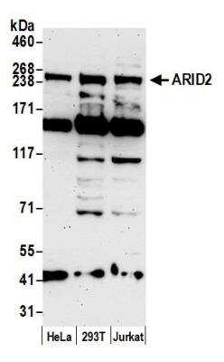 Western Blot: ARID2 Antibody [NBP1-26614]
