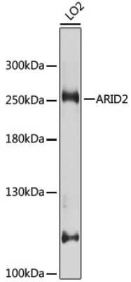 Western Blot: ARID2 AntibodyBSA Free [NBP2-92943]