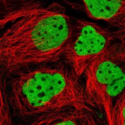 Immunocytochemistry/ Immunofluorescence: ARID3B Antibody [NBP2-33596]