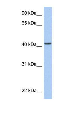 Western Blot: ARID3C Antibody [NBP1-79363]