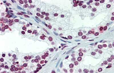 Immunohistochemistry: ARID5A Antibody [NBP1-79441]