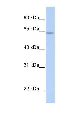 Western Blot: ARID5A Antibody [NBP1-79440]