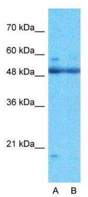 Western Blot: ARID5A Antibody [NBP1-79440]
