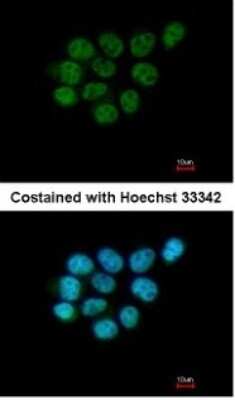 Immunocytochemistry/ Immunofluorescence: ARIH2 Antibody [NBP1-31044]