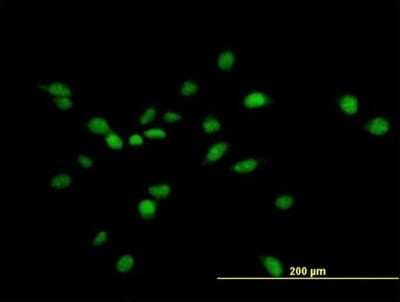 Immunocytochemistry/ Immunofluorescence: ARK5/NUAK1 Antibody [H00009891-B01P]