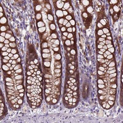 Immunohistochemistry: ARL1 Antibody [NBP2-49680]