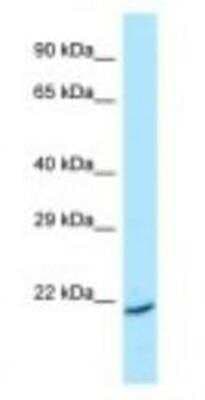Western Blot: ARL1 Antibody [NBP1-98485]