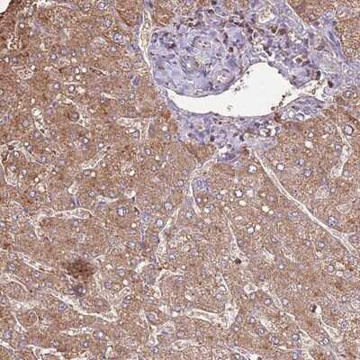 Immunohistochemistry-Paraffin: ARL10 Antibody [NBP2-14311]
