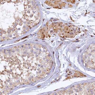 Immunohistochemistry-Paraffin: ARL11 Antibody [NBP1-88989]