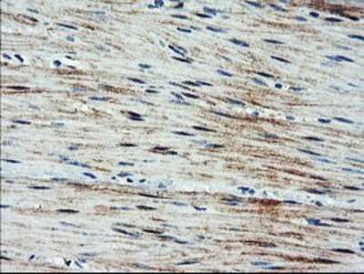 Immunohistochemistry: ARL11 Antibody (OTI1A5) - Azide and BSA Free [NBP2-72348]