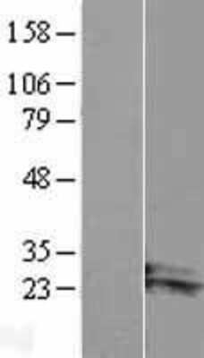 Western Blot: ARL14 Overexpression Lysate [NBL1-07690]