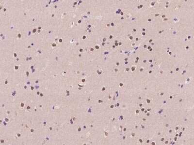 Immunohistochemistry-Paraffin: ARL14EP Antibody [NBP2-97378]
