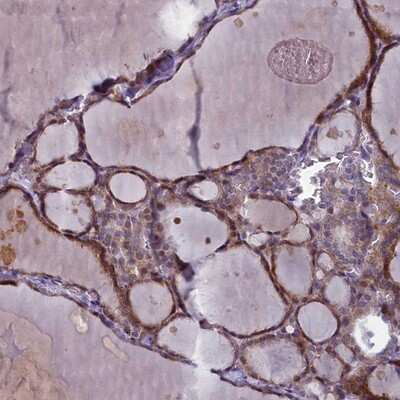 Immunohistochemistry-Paraffin: ARL15 Antibody [NBP1-94142]