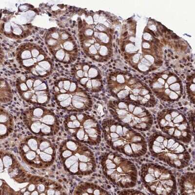 Immunohistochemistry-Paraffin: ARL2 Antibody [NBP1-91680]