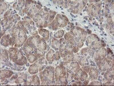 Immunohistochemistry: ARL2BP Antibody (OTI1A10) - Azide and BSA Free [NBP2-71743]