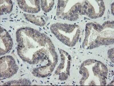 Immunohistochemistry: ARL2BP Antibody (OTI1A10) [NBP2-46541]