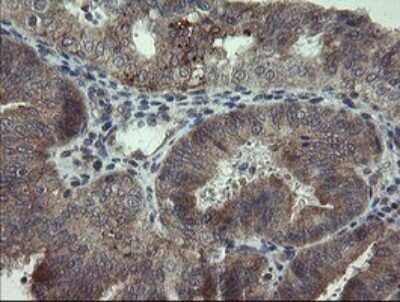 Immunohistochemistry: ARL2BP Antibody (OTI1A10) [NBP2-46541]