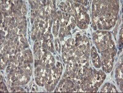 Immunohistochemistry: ARL2BP Antibody (OTI1A10) [NBP2-46541]