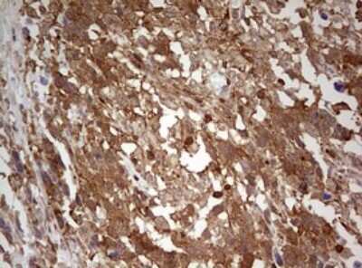 Immunohistochemistry: ARL3 Antibody (OTI1C6) [NBP2-46542]