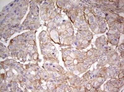 Immunohistochemistry: ARL3 Antibody (OTI1C6) - Azide and BSA Free [NBP2-70206]