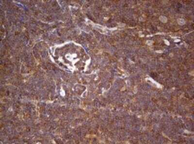 Immunohistochemistry: ARL3 Antibody (OTI1C6) - Azide and BSA Free [NBP2-70206]