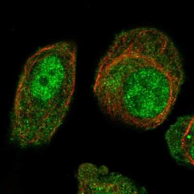 Immunocytochemistry/ Immunofluorescence: ARL4 Antibody [NBP2-55774]
