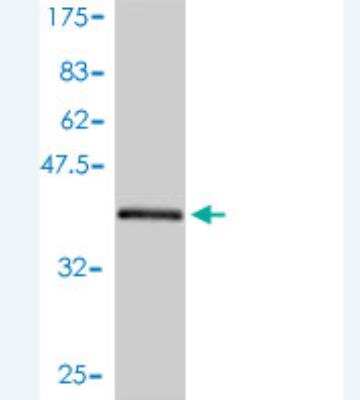 Western Blot: ARL5A Antibody (1F12-1A6) [H00026225-M01]