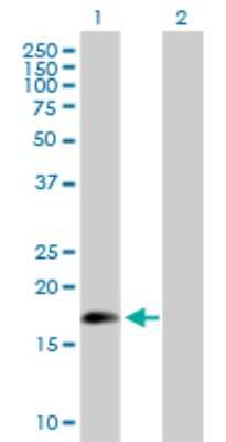 Western Blot: ARL5A Antibody [H00026225-B01P]