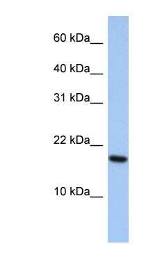 Western Blot: ARL5A Antibody [NBP1-58304]