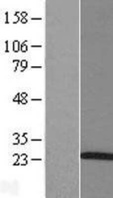 Western Blot: ARL5A Overexpression Lysate [NBL1-07697]