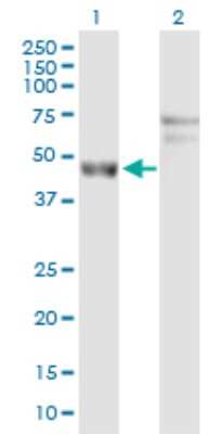 Western Blot: ARL6IP4 Antibody [H00051329-D01P]