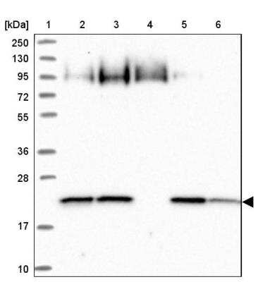 Western Blot: ARL8A Antibody [NBP2-14314]
