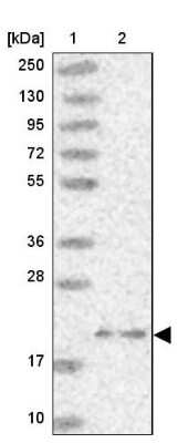 Western Blot: ARL8A Antibody [NBP2-14316]